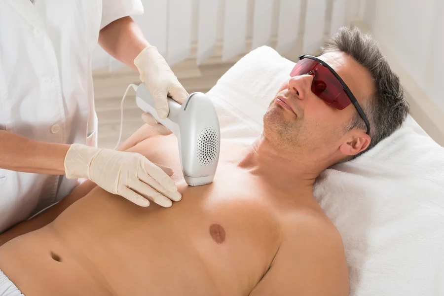 Electrolysis Hair Removal Guide for Smooth Long Lasting Results
