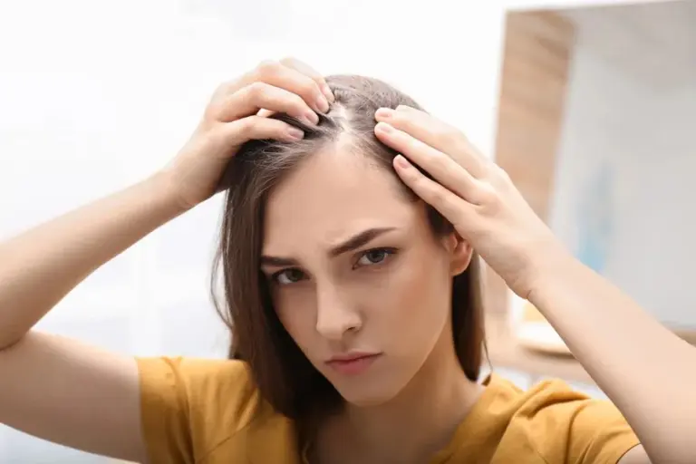 Receding Hairline Causes, Signs, Treatment, and Care Tips